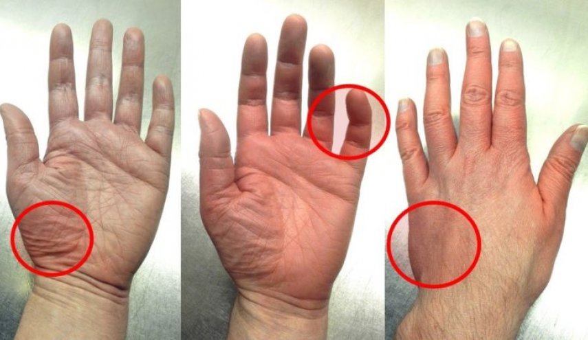 تعرف على طرق قياس ضغط الدم في المنزل و بدون جهاز