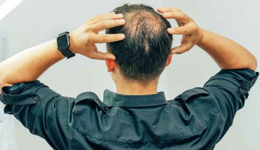 تحذير للرجال.. باحثون يحددون ساعات العمل التي تؤدي إلى الصلع