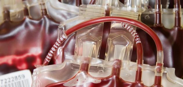 تعرف على أسباب فقر الدم بعوز الحديد وعلاجه!