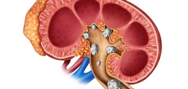 تعرف على بعض الأعشاب المهمة للكلى