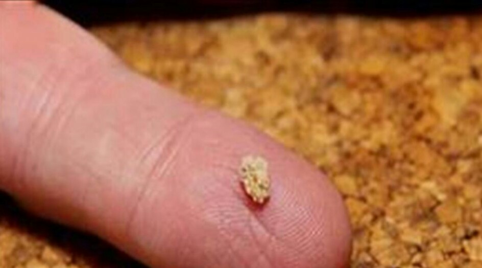 شراب يفتت حصى الكلى.. جرّبوه!