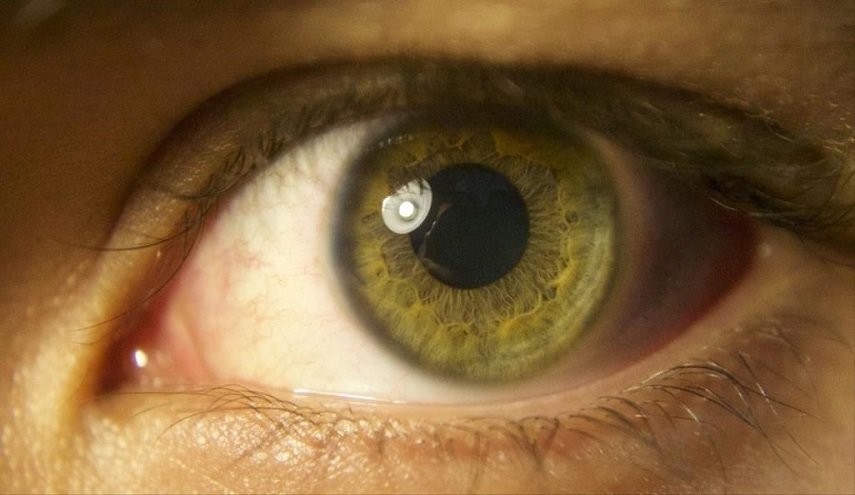 هذه العلامات تنذر بإصابة عينك بأمراض خطيرة