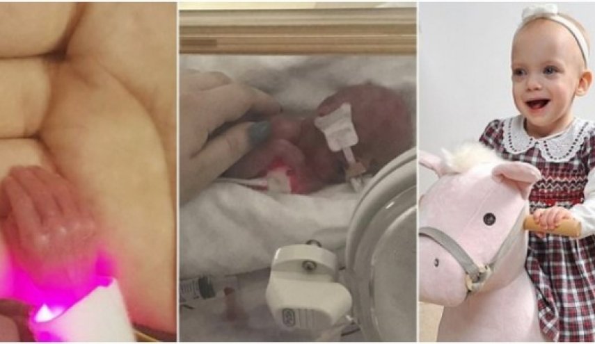 هكذا تتحدى مولودة توقعات الأطباء بوفاتها!