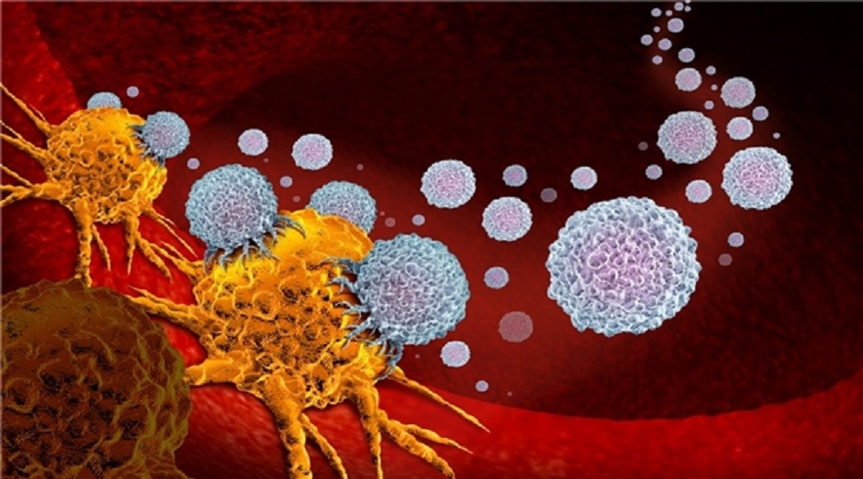 باحثون ايرانيون يبتكرون طريقة جديدة للكشف المبكر عن الاصابة بسرطان المثانة