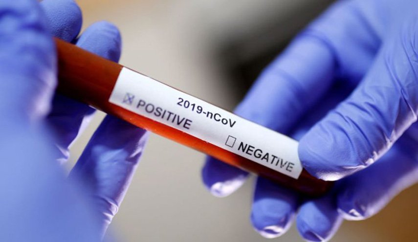 الصين تكشف عن سلالة ثانية من فيروس كورونا أشد فتكا