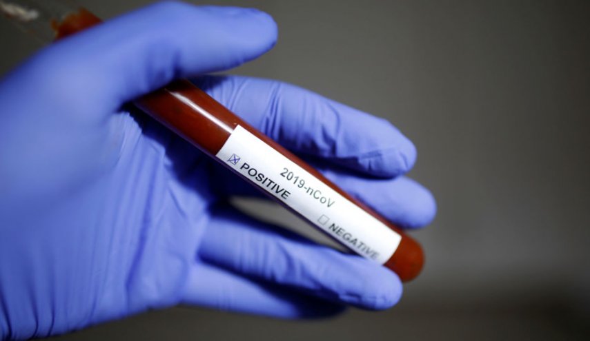 تسجيل اصابة جديدة بكورونا لفتاة في السليمانية بكردستان العراق