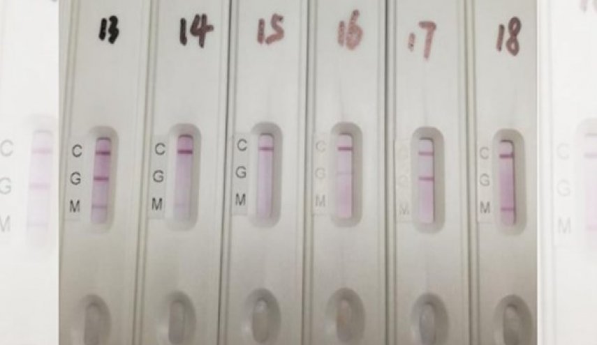 متخصصون ايرانيون ينجحون في تصميم عدة تشخيص كورونا