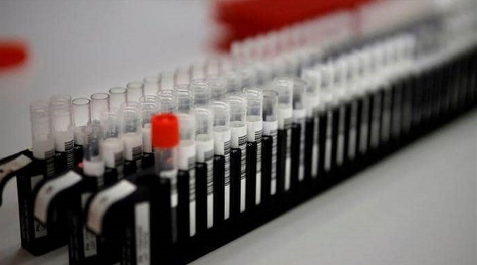 علماء يطورون مادة معقمة تحمي بشدة من عدوى وباء كورونا