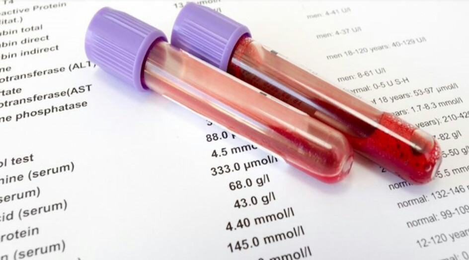 هذه هي دلالات العبارات المختصرة في نتائج فحص الدم