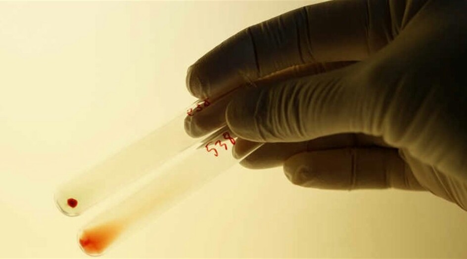 دراسة تكشف عن فصيلة الدم الأكثر عرضة لكورونا