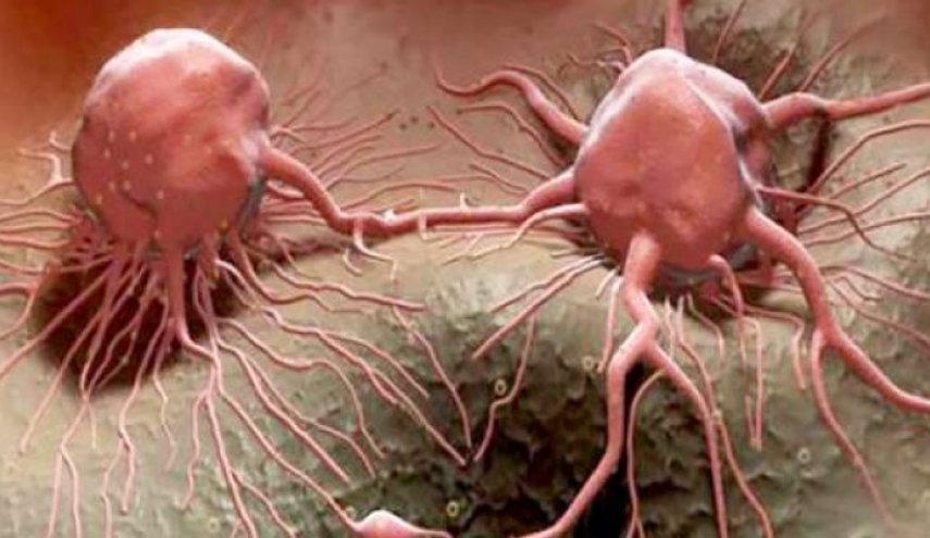  العامل المسبب لزيادة خطر الوفاة بالسرطان.. تعرف عليه؟!