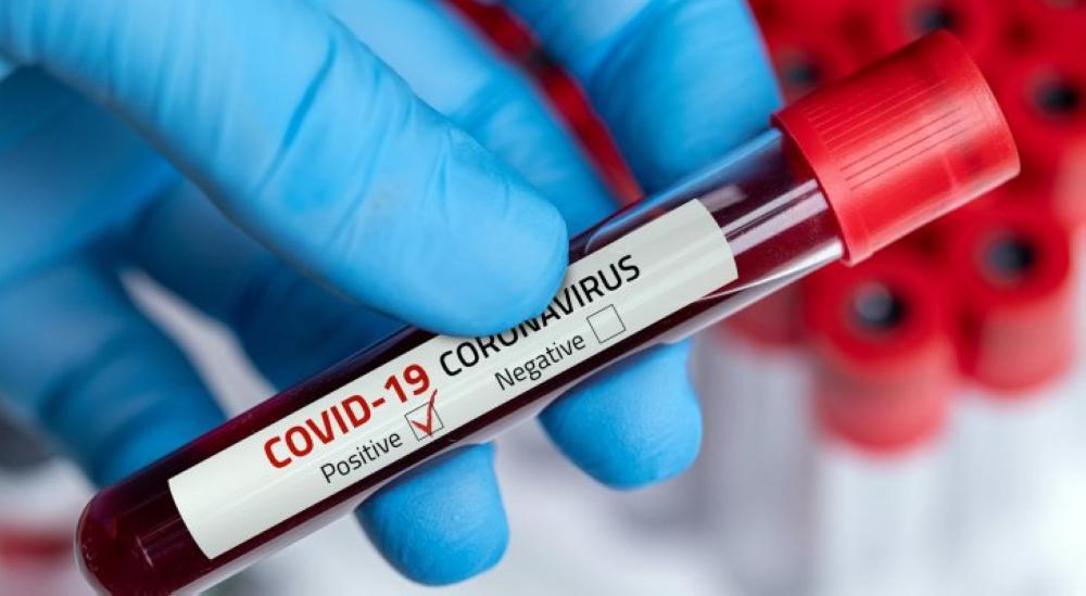 دراسة مفاجئة عن  “كوفيد-19” 