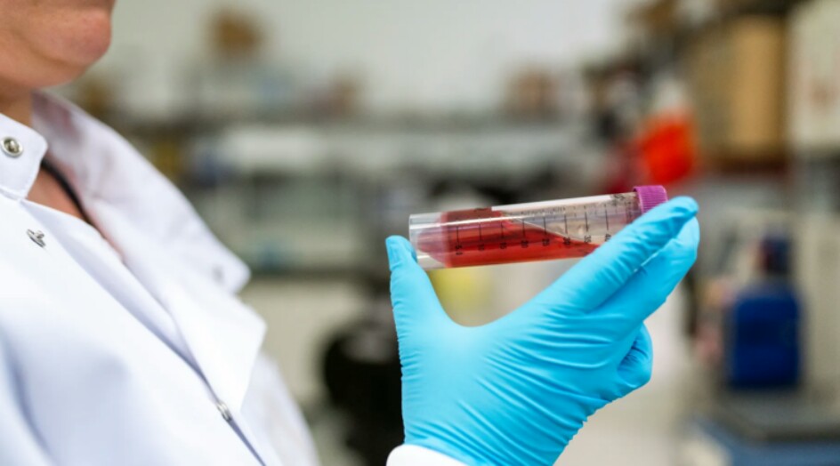 نوع غذائي يساعد في خفض نسبة السكر في الدم والوقاية من مرض خطير!