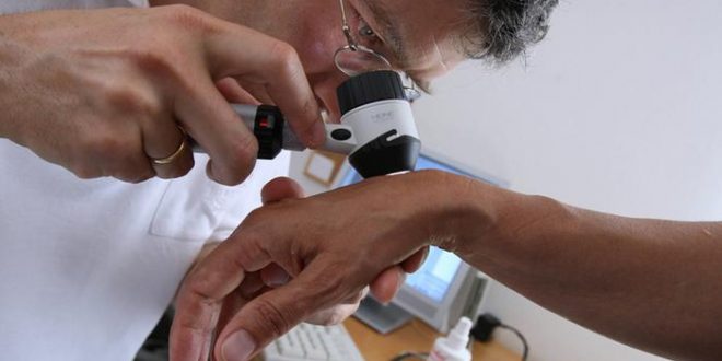 ثمانية تغيرات على جلدك تنبئك بأمراض في الكبد والأمعاء