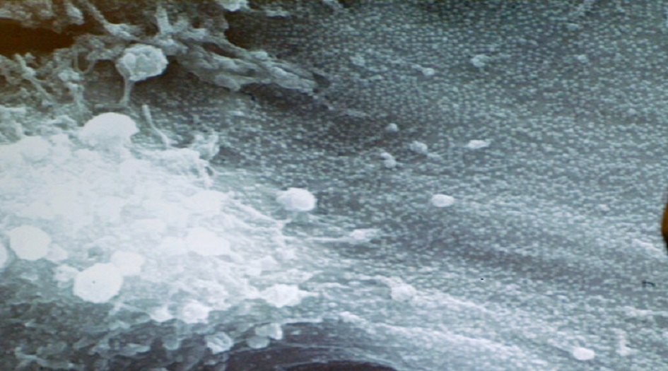 اكتشاف "سر" انتشار عدوى الفيروس التاجي