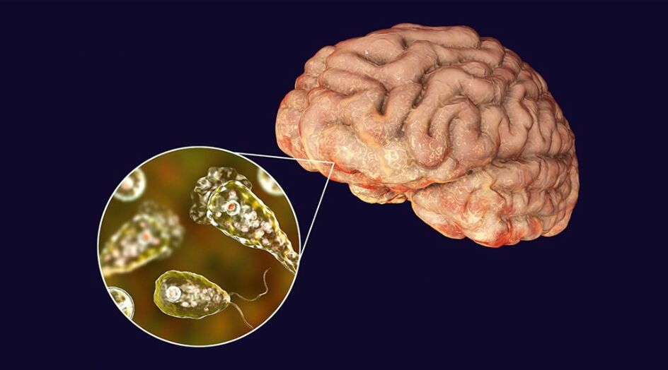 تحذير ... عدوى فيروسية آكلة للدماغ!