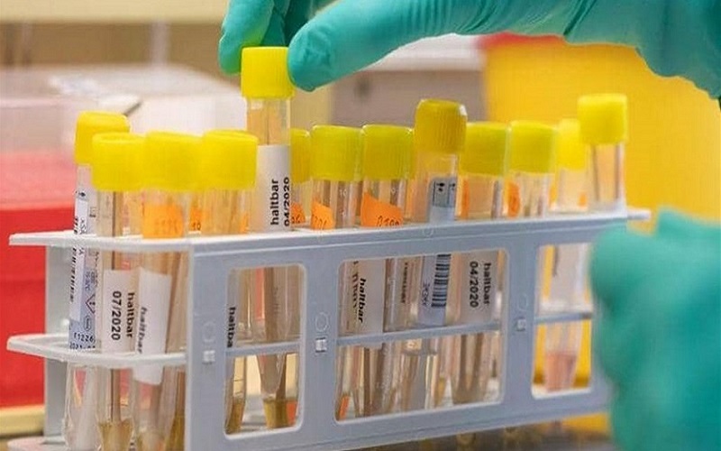 النتيجة "غير متوقعة".. مدينة تجري 3 ملايين اختبارا لكورونا