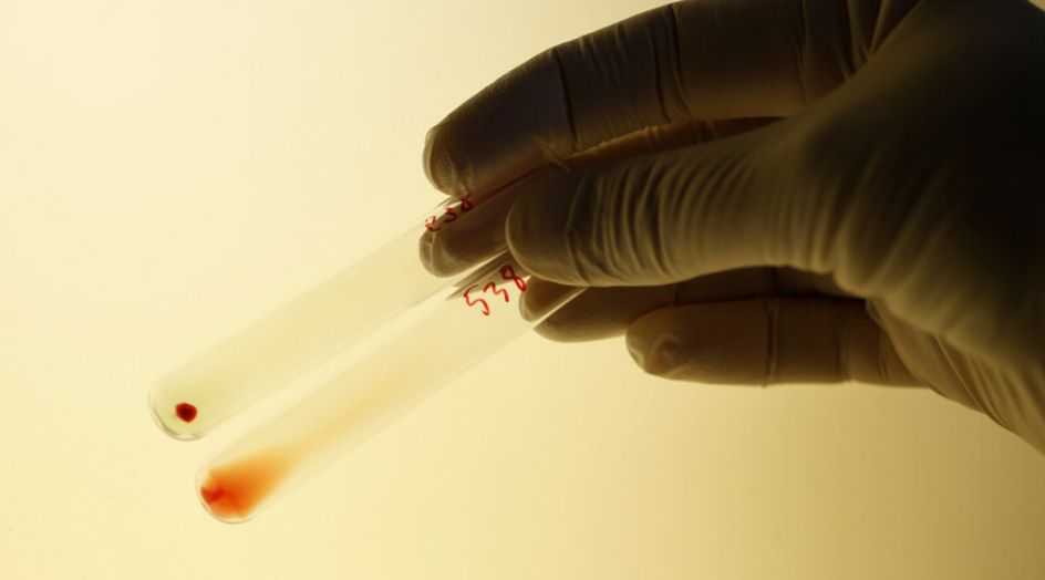 دراستان تكشفان عن فصيلة دم الأشخاص الأقل عرضة للإصابة بكورونا