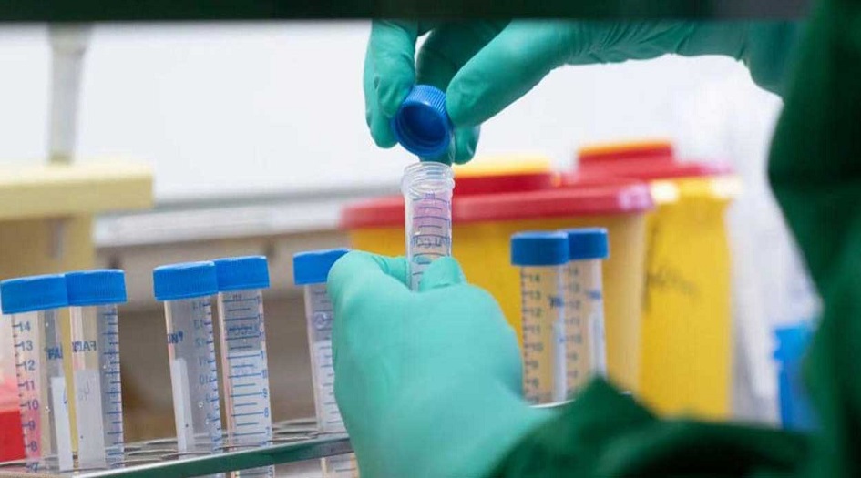 الاعلان عن التوصل لعلاج يقضي على كورونا  تماماً