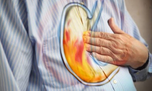 أطعمة تخفف من حموضة المعدة .. تعرف اليها