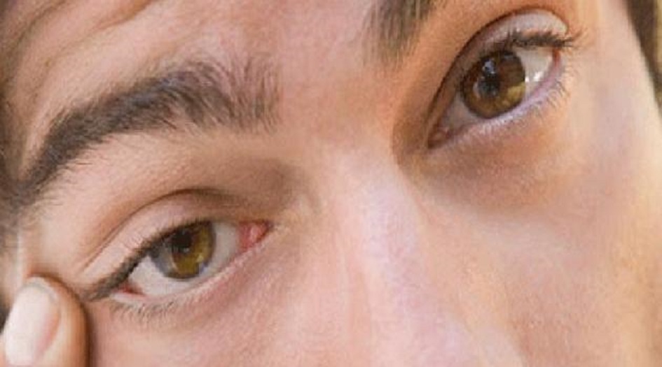 ما اسباب رعشة العين وكيف توقفها؟