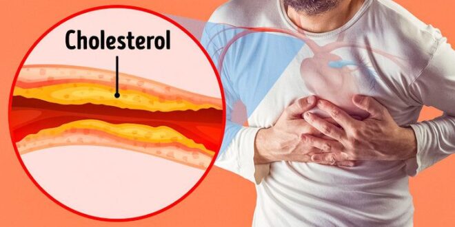 علامات انسداد الشرايين التي نتجاهلها في أغلب الأحيان