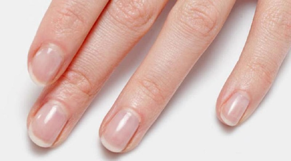 علامة خفية تدل على إصابتك بمرض السكر.. تعرف عليها