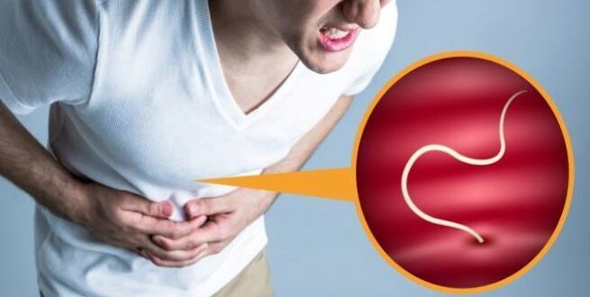 ديدان البطن.. وأسباب الإصابة بها، والأعراض و العلاج
