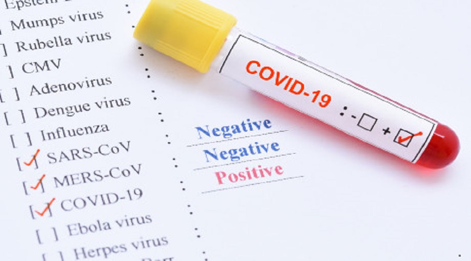 ايران... تسجيل 251 حالة وفاة جديدة بفيروس كورونا 