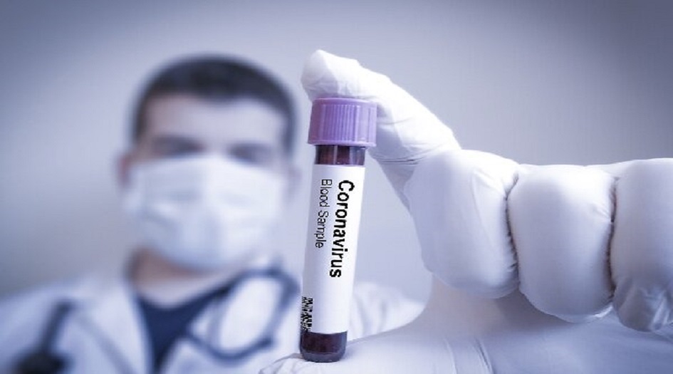 اخر احصائيات كورونا في ايران  