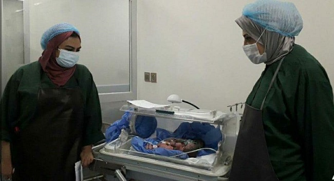 البصرة: عملية قيصرية نادرة لولادة توأم ملتصق (صورة)