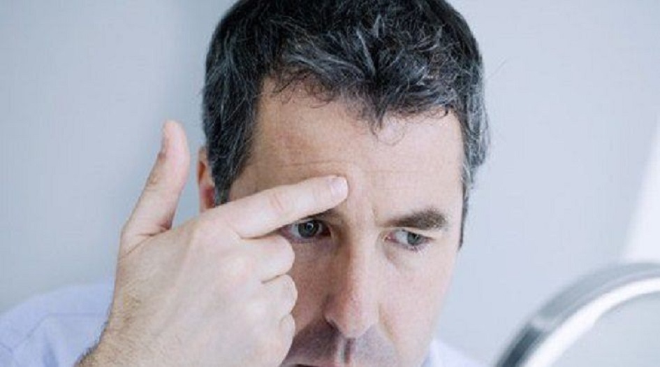 تعرف على علاجات منزلية للتخلص من تجاعيد الجبهة