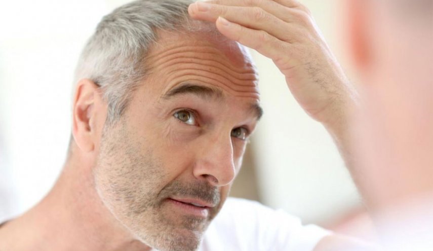 بدون جراحة.. وداعاً أزمة صلع الرجال نهائيا
