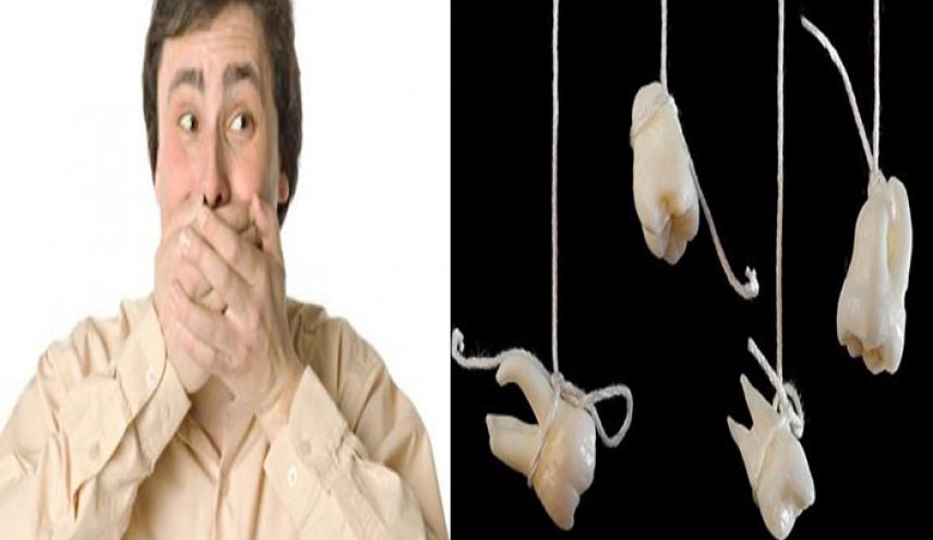  فقدان الأسنان... تحذير من الإصابة بمرض مناعي !