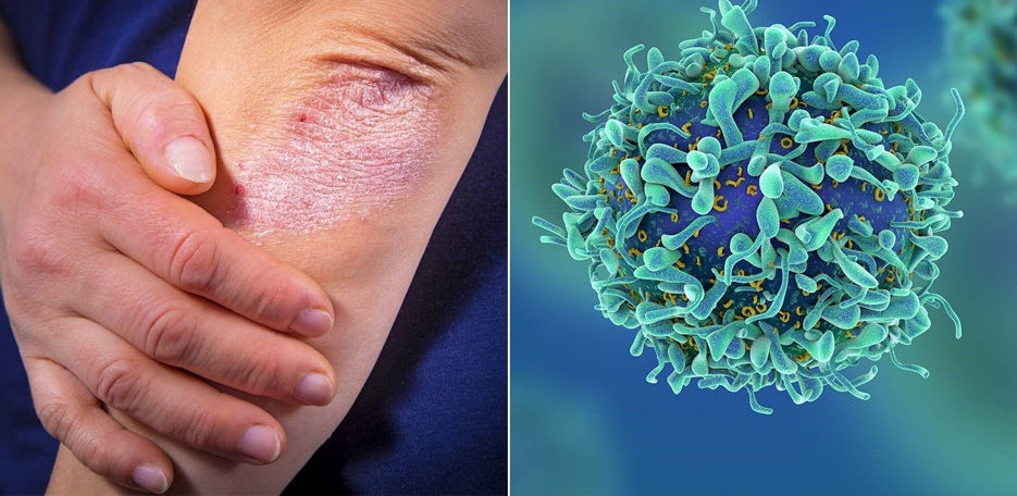 نشانه‌های سرطان پوست که نادیده گرفته می‌شوند