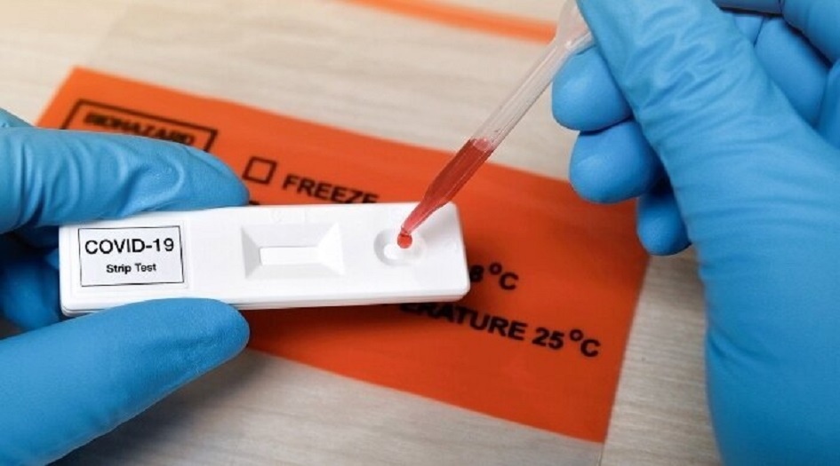 الصحة الايرانية:  كورونا تسفر عن 88 حالة وفاة جديدة