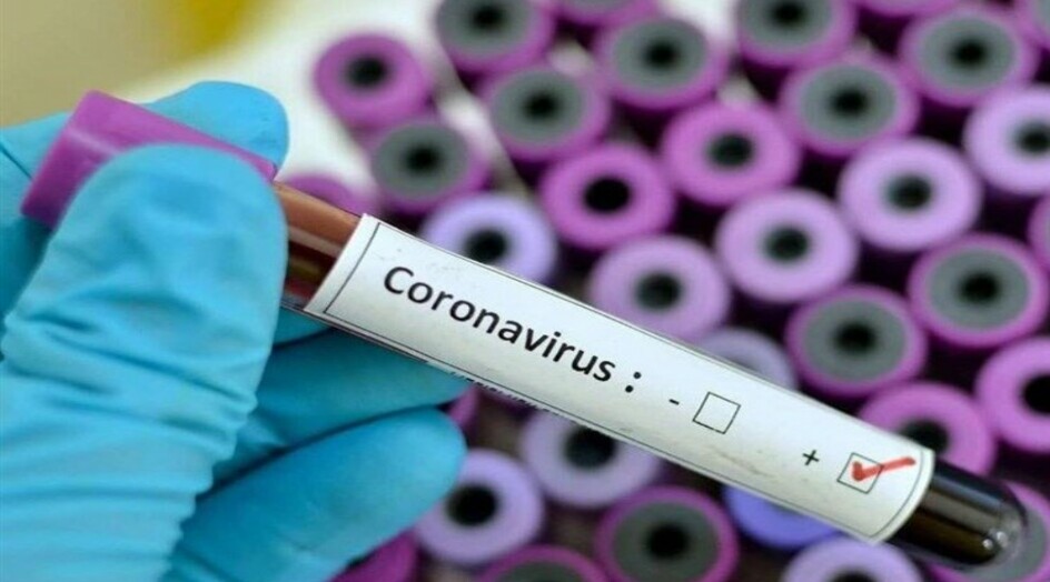 قائمة محدثة بأكثر الدول تضررا من كورونا والولايات المتحدة في الصدارة