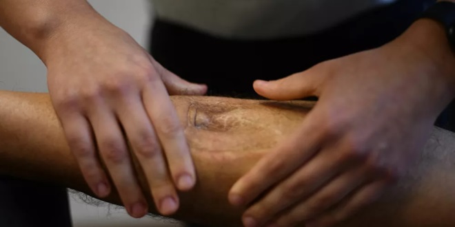 5 أعراض لـ “الموت الصامت” في الساقين يحذر منها العلماء