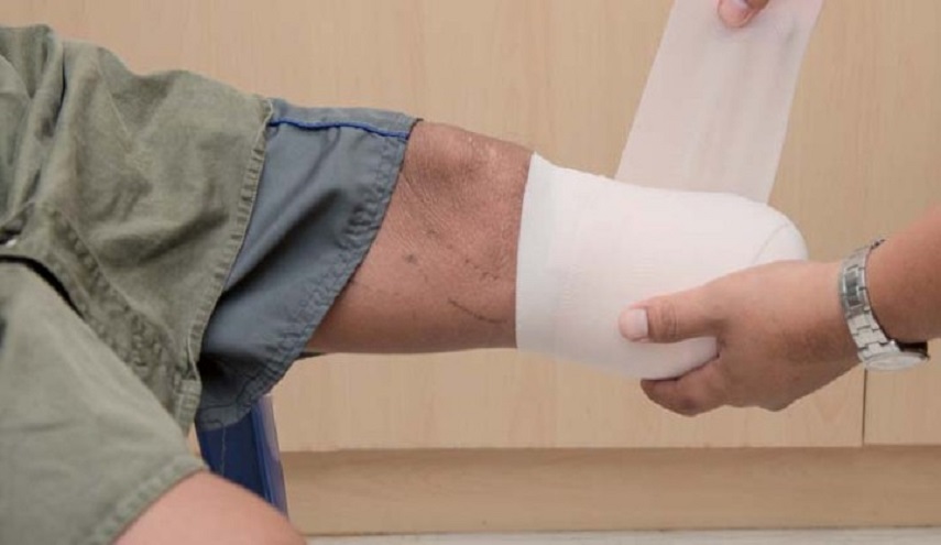 خطأ طبي كارثي... بتر الساق السليمة بدلا من المريضة