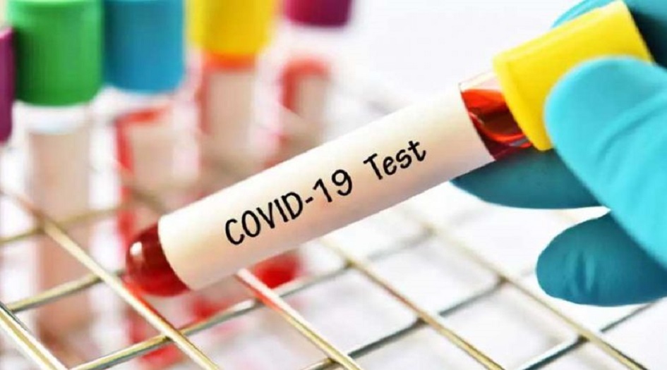 الصحة الايرانية تسجل 108 حالة وفاة جديدة بكورونا