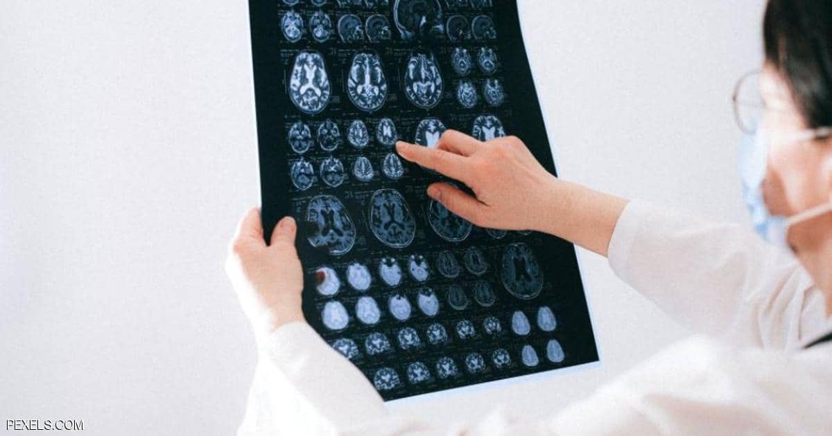 العلماء في حيرة بسبب كورونا.. والسر في "الدماغ"!