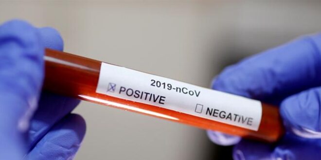 ما هو الوقت المثالي لإجراء اختبار كورونا؟