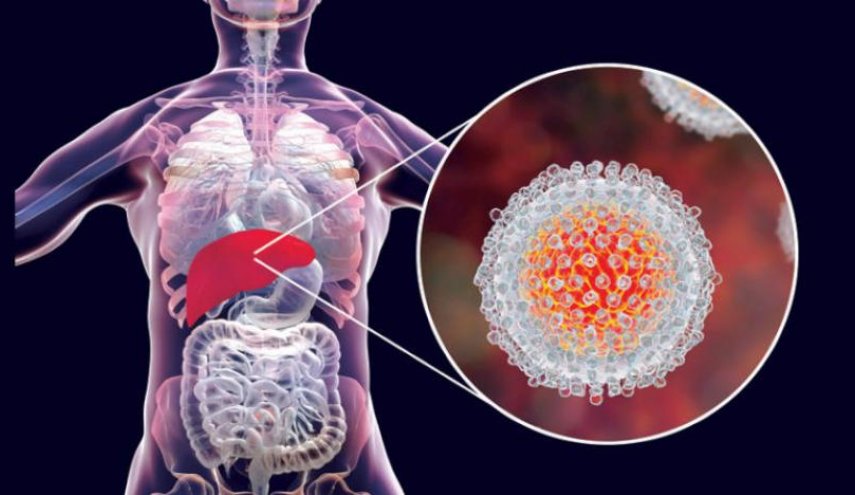 الكبد الوبائي.. تعرف على أعراض المرض وأسبابه وطرق العلاج