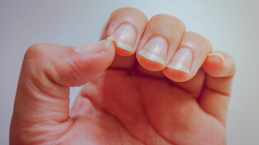 5 أعراض في أظافرك تحدد الإصابة من عدمها بفيروس كورونا