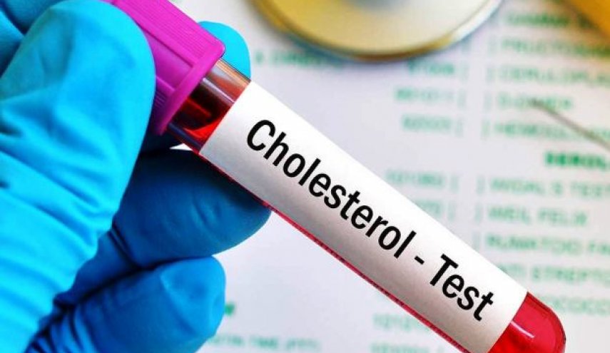 أسوأ أنواع الأطعمة المسببة لزيادة الكوليسترول!