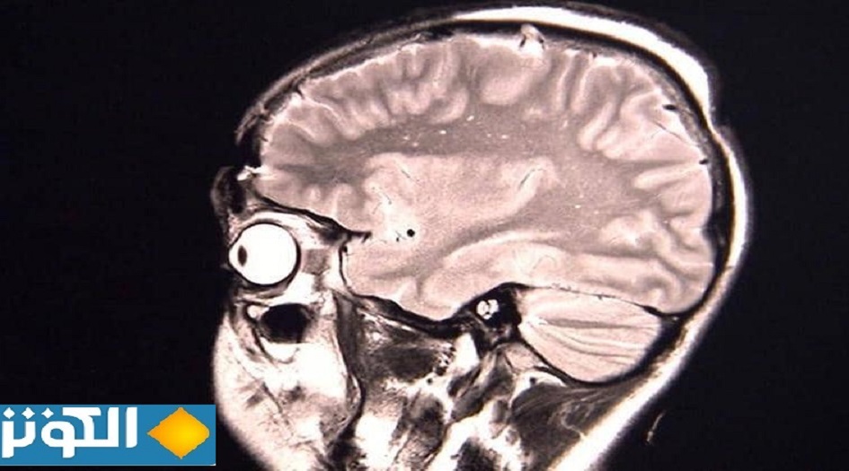 كورونا يسبب جنون العظمة.. والفئة غير متوقعة
