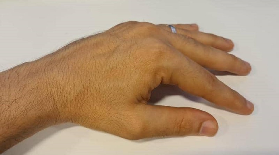 أصابع يديك وقدميك.. كيف تدلك على "القاتل الصامت"؟