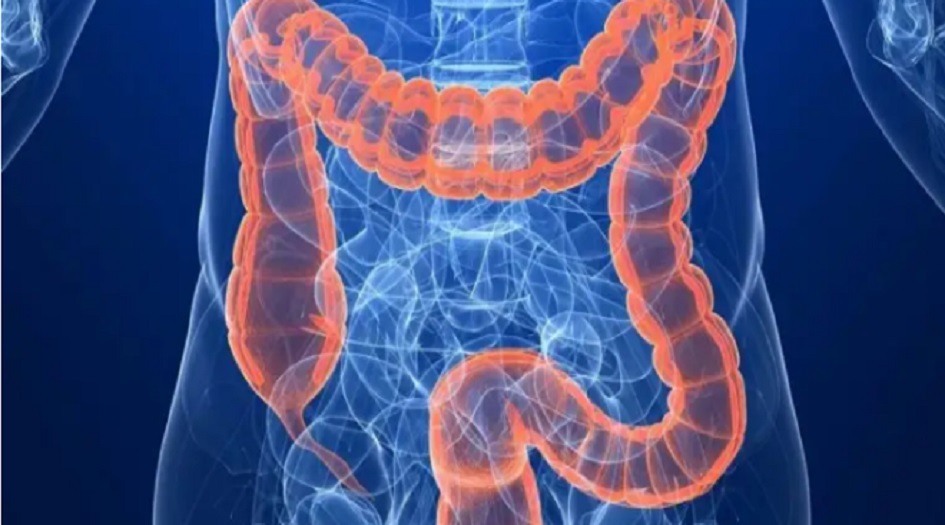 هذا مايجب تناوله وتجنّبه لتنظيف القولون