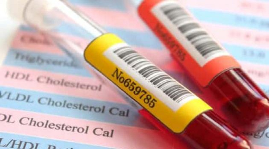 تعرف على العلامات الأربعة التي تدل على ارتفاع نسبة الكوليسترول في الدم