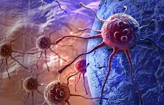 سه قانون طلایی برای پیشگیری از سرطان